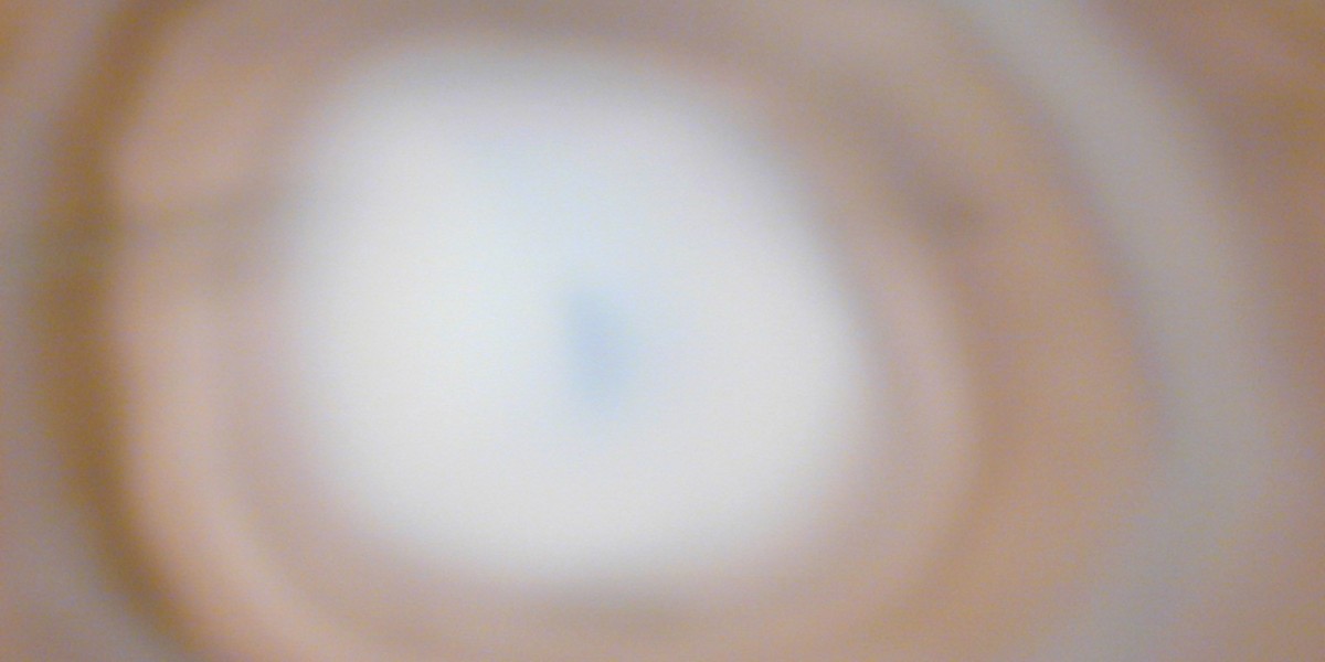 Somatotropin