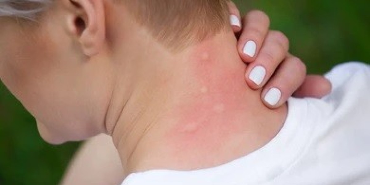 How Fenbendazole Effectively Treats Human Intestinal Parasites