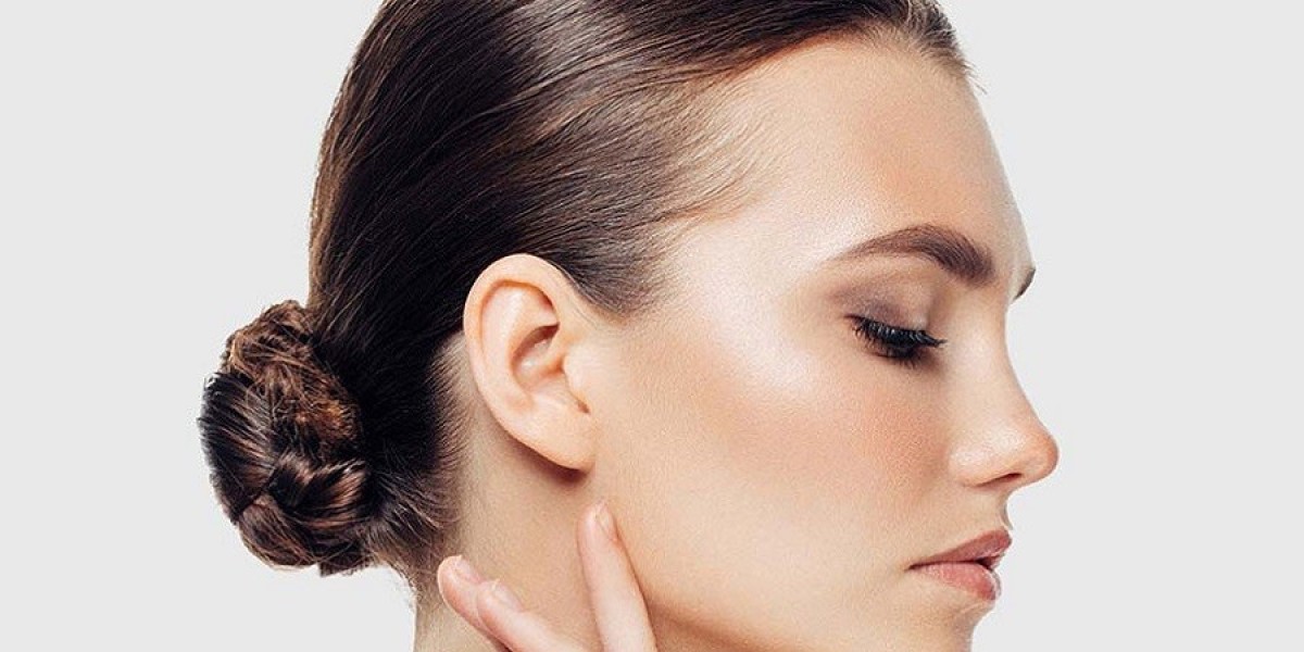 Can Alarplasty Deliver Natural-Looking Nose Refinement?