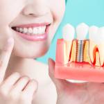dentalimplants Metairie Profile Picture
