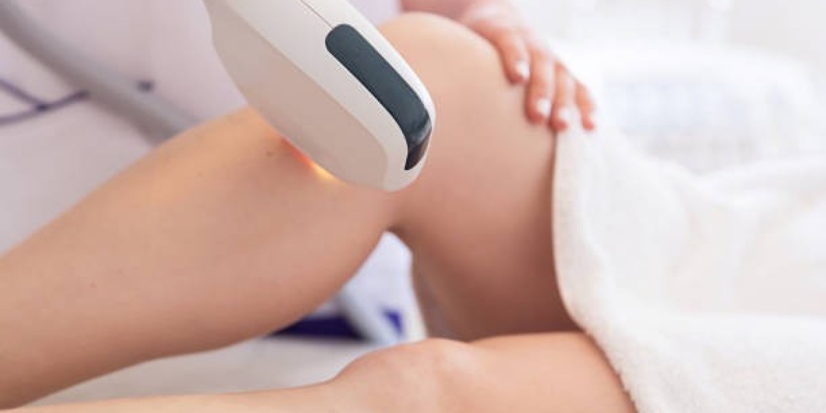 Holistic Benefits of Laser Hair Removal Lifestyle