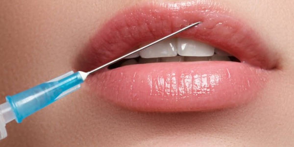 Russian Lip Fillers Myths Debunked: No Duck Lips Guarantee