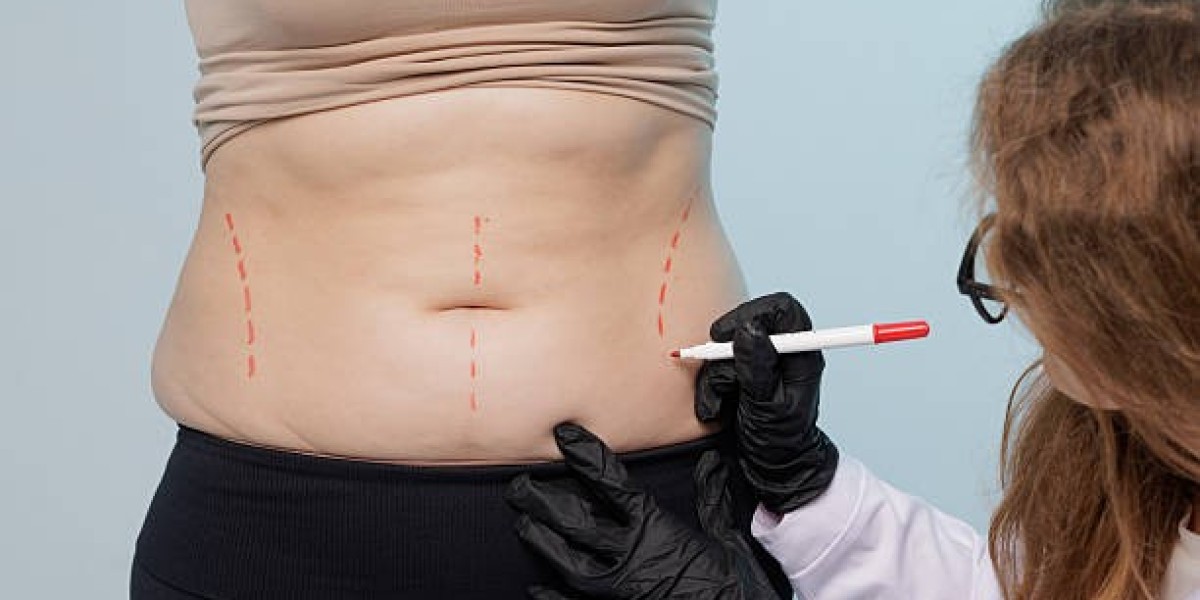Does Liposuction Heighten Tactile Awareness?