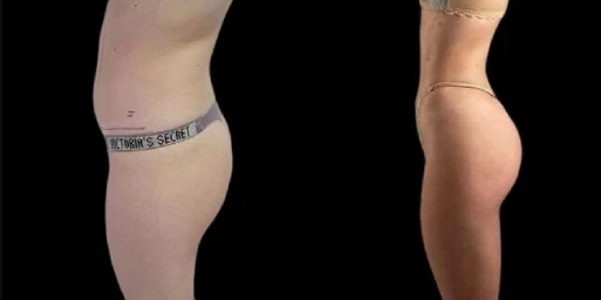 J-Plasma Treatments in Dubai: Real Results You Can See and Feel