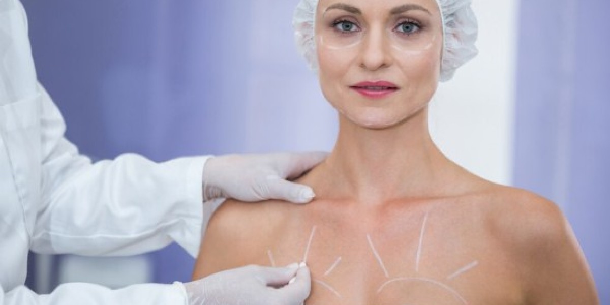 Come la Mastoplastica Può Armonizzare le Proporzioni del Corpo