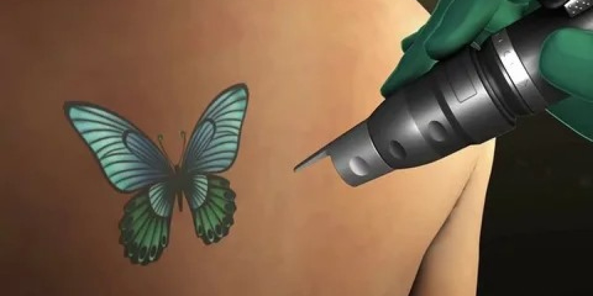 Is Sun Exposure a Concern After Picosure Tattoo Removal in Dubai?