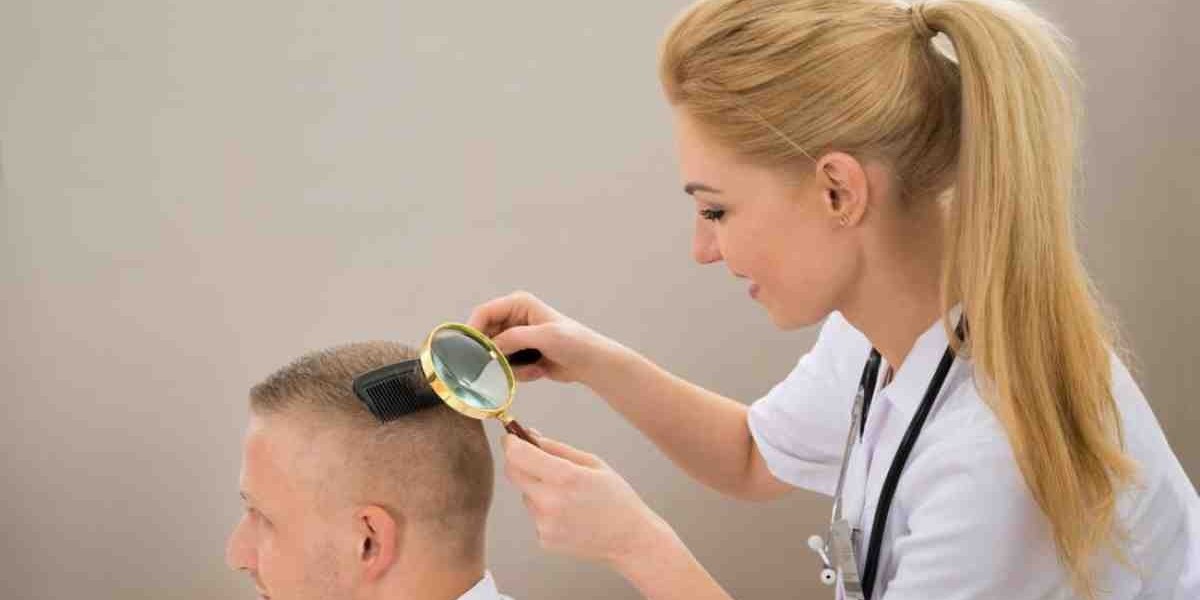 Who Is the Best Hair Specialist Doctor in Dubai for Hair Loss?