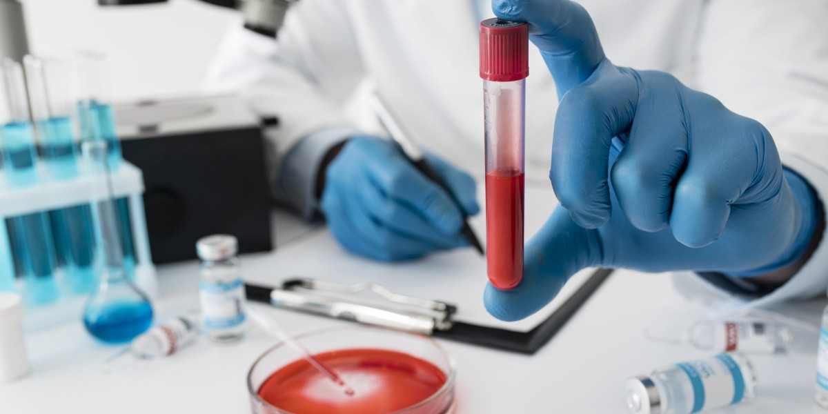 Your Complete Guide to Getting a Blood Test in Bangalore