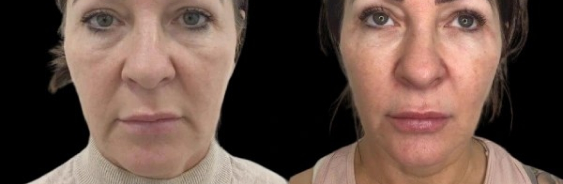 Skincare treatments Cover Image