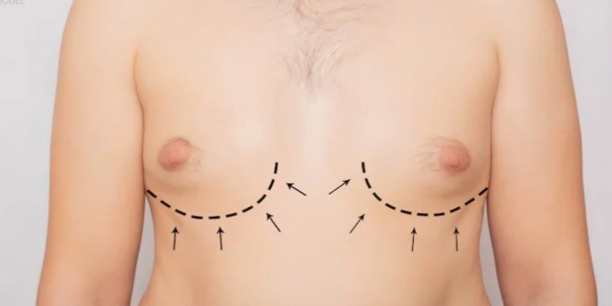 Gynecomastia in Dubai – Recovery and Aftercare