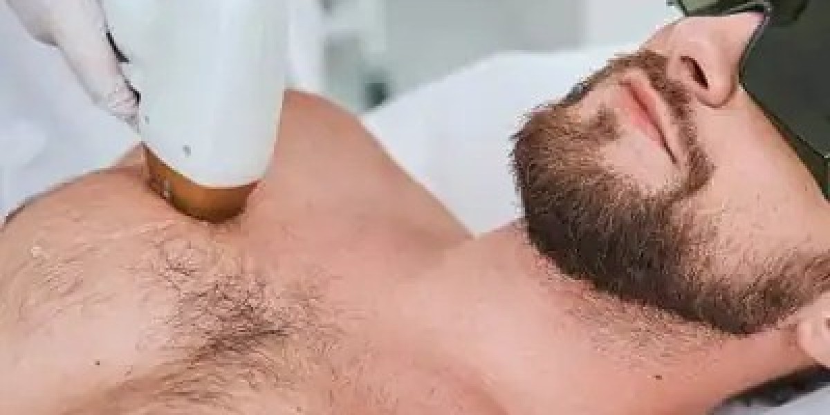 Laser Hair Removal in Islamabad – A Modern Solution for Smooth Skin at Enfield Royal Clinic