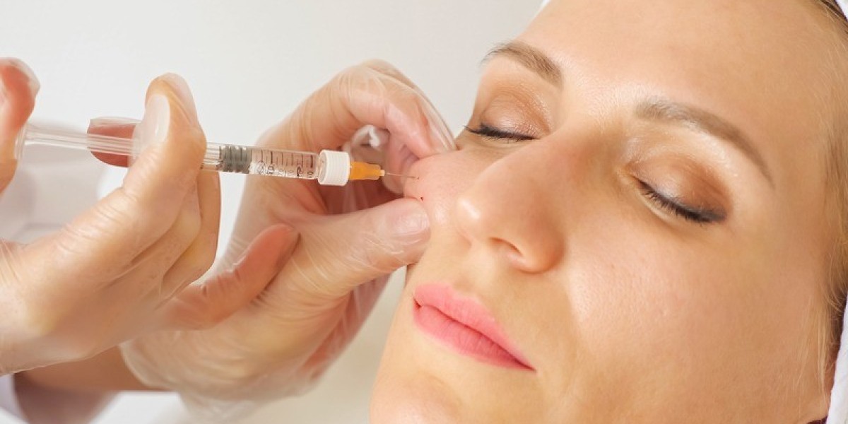 Cheek Fillers Injections: Are They Right for You?