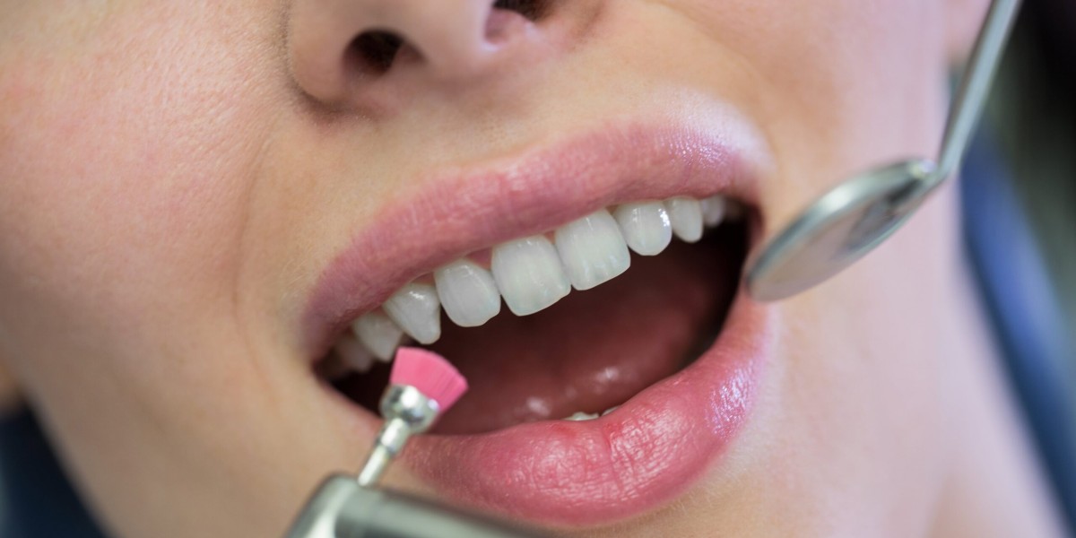 When to Expect Lower Teeth Whitening Cost in Dubai